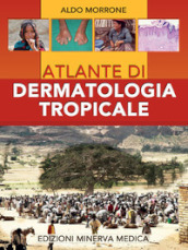 Atlante di dermatologia tropicale