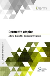 Dermatite atopica