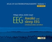 EEG : Awake and Sleep