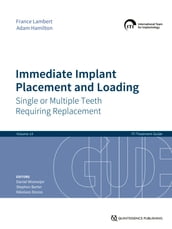 Immediate Implant Placement and Loading Single or Multiple Teeth Requiring Replacement