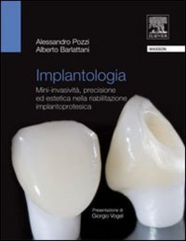 Implantologia. Mini-invasività, precisione ed estetica nella riabilitazione implantoprotesica - Alessandro Pozzi - Alberto Barlattani