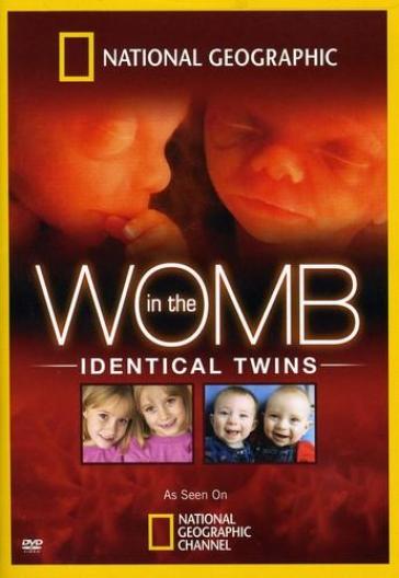 In the womb:identical twins - Geographic National