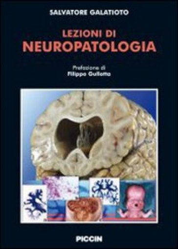 Lezioni di neuropatologia - Salvatore Galatioto