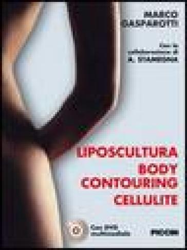 Liposcultura body contouring cellulite. Con DVD - Marco Gasparotti