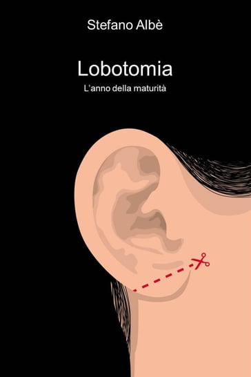 Lobotomia - Stefano Alb