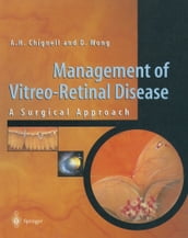 Management of Vitreo-Retinal Disease