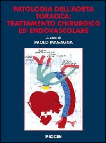 Patologia dell'aorta toracica. Trattamento chirurgico ed endovascolare - Paolo Magagna