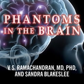 Phantoms in the Brain