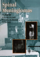 Spinal Meningiomas