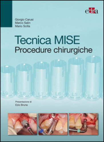 Tecnica MISE. Procedure chirurgiche - Giorgio Carusi - Marco Salin - Mario Scilla