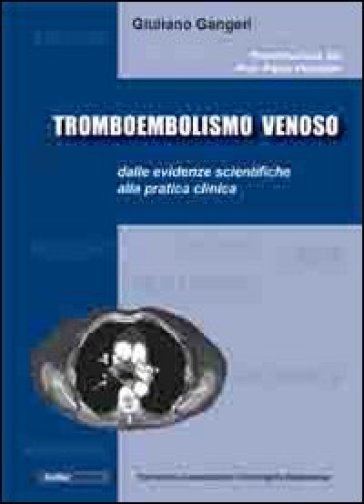 Tromboembolismo venoso: dalle evidenze scientifiche alla pratica clinica - Giuliano Gangeri