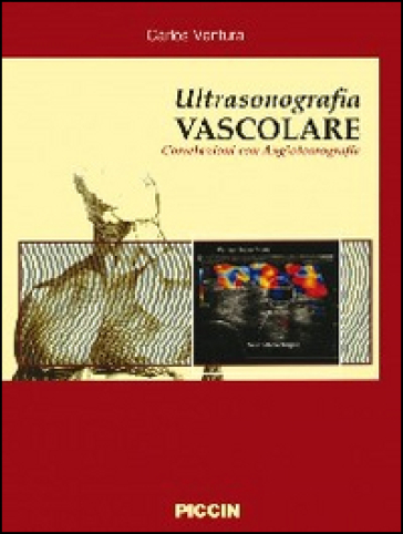 Ultrasonografia vascolare. Correlazioni con angiotomografia - Carlos Ventura