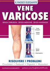 Vene varicose - Prevenire, ridurre ed eliminare