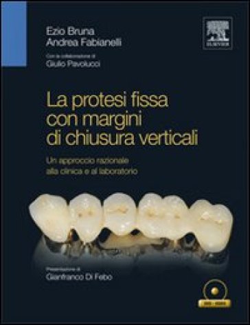 La protesi fissa con margini di chiusura verticali - Ezio Bruna - Andrea Fabianelli