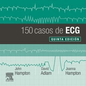 150 casos de ECG