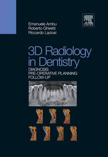 3D Radiology in Dentistry - Emanuele Ambu - Roberto Ghiretti - Riccardo Laziosi