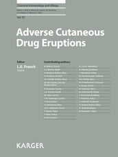 Adverse Cutaneous Drug Eruptions