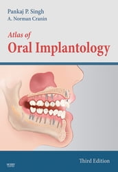 Atlas of Oral Implantology - E-Book