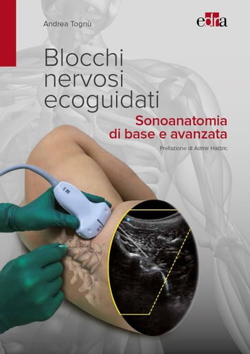 Blocchi nervosi ecoguidati - Andrea Tognù