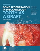 Bone regeneration in implantology: tooth as a graft