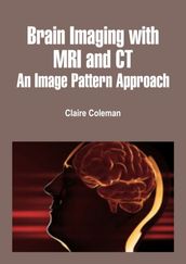 Brain Imaging with MRI and CT