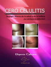 Cero celulitis