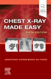 Chest X-Ray Made Easy E-Book