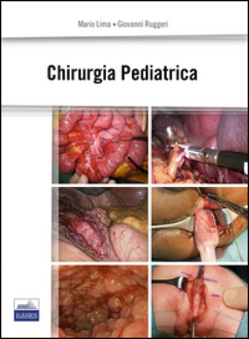 Chirurgia pediatrica - Mario Lima - Giovanni Ruggeri