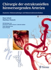 Chirurgie der extrakraniellen hirnversorgenden Arterien