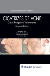 Cicatrizes de Acne