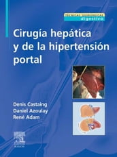 Cirugía hepática y de la hipertensión portal