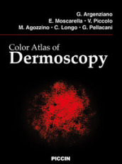 Color atlas of dermoscopy