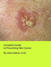 Complete Guide to Preventing Skin Cancer