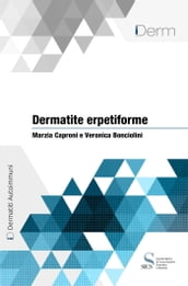 Dermatite erpetiforme