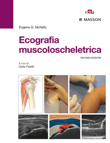 Ecografia muscoloscheletrica - Eugene G. McNally