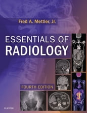 Essentials of Radiology E-Book