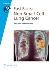 Fast Facts: Non-Small-Cell Lung Cancer