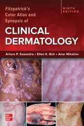 Fitzpatrick s Color Atlas and Synopsis of Clinical Dermatology, 9/e