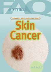 Frequently Asked Questions About Skin Cancer
