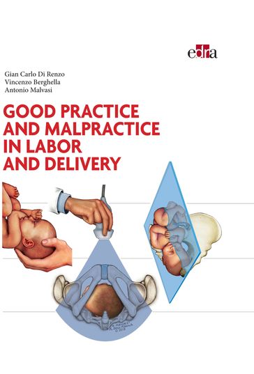 Good practice and malpractice in labor and delivery - Gian Carlo Di Renzo - Vincenzo Berghella - Antonio Malvasi