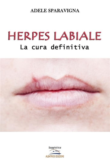 Herpes labiale  La cura definitiva - Adele Sparavigna