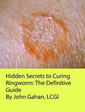 Hidden Secrets to Curing Ringworm: The Definitive Guide