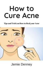How to Cure Acne