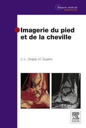 Imagerie du pied et de la cheville