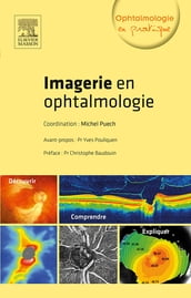 Imagerie en ophtalmologie