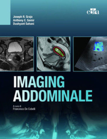 Imaging addominale - Joseph R. Grajo - Dushyant Sahani - Anthony E. Samir