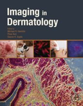 Imaging in Dermatology