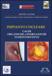 Impianto cocleare. Cause organiche e inorganiche di reintervento. Ediz. illustrata