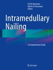 Intramedullary Nailing