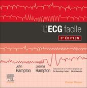 L ECG facile